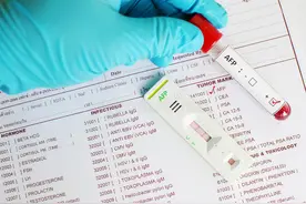 乙肝五项指标该怎么看?图片