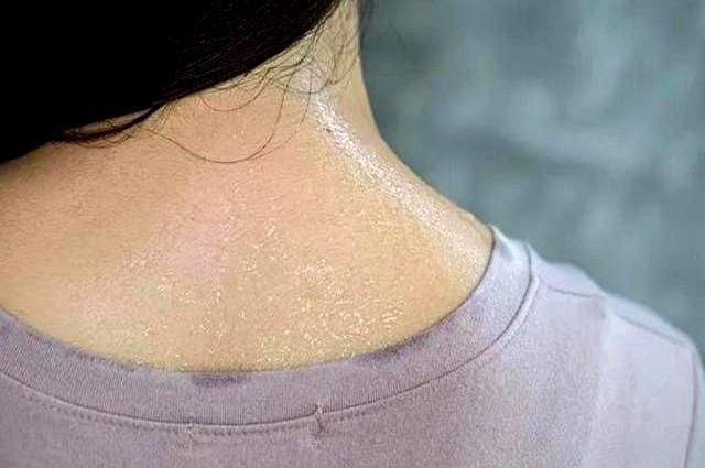 医生发现：夏季还坚持戴帽子的人！用不了多久，身体或会有5改善