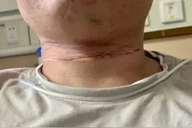 5cm血痕！一根纤细的风筝线，瞬间割向他的颈部！图片