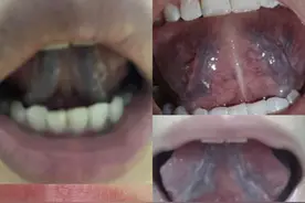 活血先疏肝，疏肝先升阳，学会这招，活血化瘀，打通全身淤堵！图片