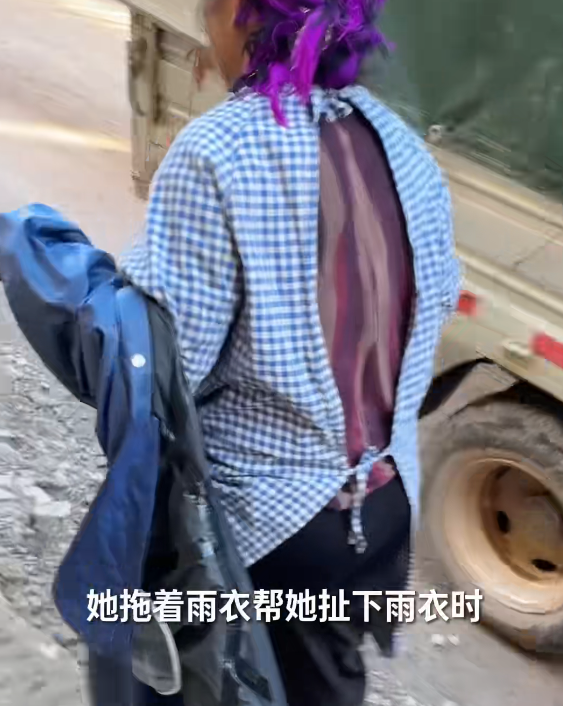 云南大姨被蜜蜂狂蜇，满脸蜂刺求助，过路司机惊呆，网友直呼惊险