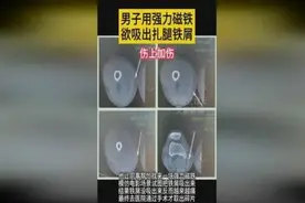 踩中铁屑堆怎么办？男子竟出此奇招，磁铁一吸，伤口更深了！图片