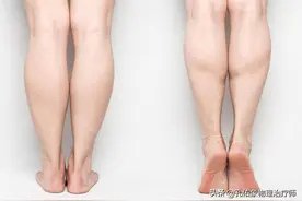 学习笔记分享：小腿健康知识图片