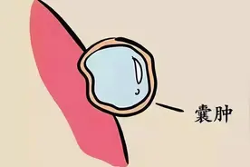 血得温行，得寒凝，一个中成药，斩断瘀血之根，补足全身阳气！图片