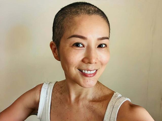 香港知名女星乳腺癌复发，头发掉光裹头巾出镜，做按摩发现病情