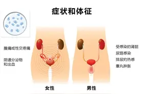 【科普】常见性病有哪些？会反复感染吗？该如何治疗？图片