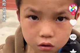 后续！广西熊孩子抓蛇带到学校，拔牙当宠物，看到他的伤疤惊呆了图片