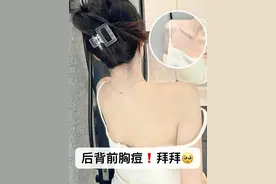 耗时3个月亲身测评热门除螨沐浴露！脓包痘痘7天就解决！图片