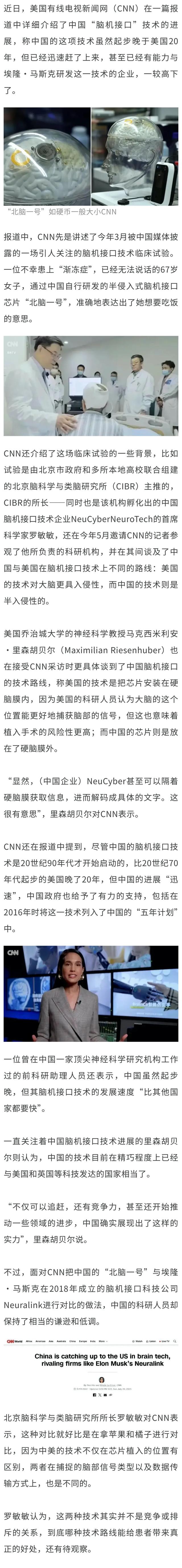 美媒报道：京产“北脑一号”智能脑机系统比肩世界前沿