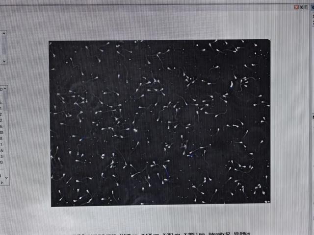 长江江豚人工繁育技术获重大突破 全球首个珍稀濒危淡水鲸类精子库在武汉建立