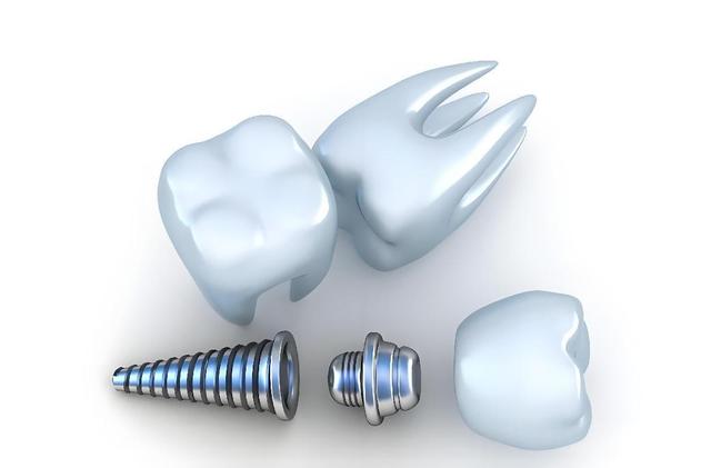 暴跌60%，引发全国牙科关店潮，曾经暴利的牙科生意要凉透了？