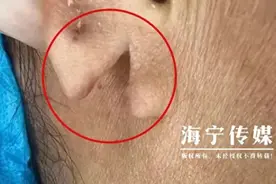 裂开！太疼了！浙江女子早上起床后，发现吓人一幕……图片