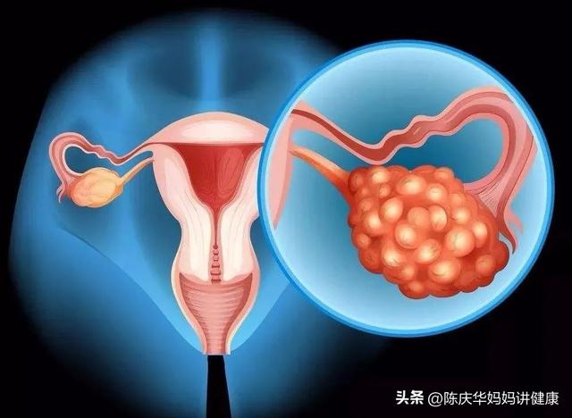 卵巢囊肿影响怀孕吗？