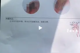女子侧躺玩手机蚊子钻进耳朵图片