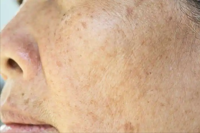 女性有没有衰老，“上半身”会说话，若一个没中，恭喜你还年轻！