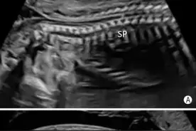 跟着超声医师来做一次大排畸，一张一张的图片带你了解宝宝的结构图片