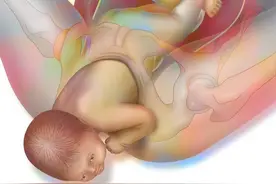 胎儿脐绕颈2圈了，谁说会绕出来的？脐绕颈这“扣”谁来帮忙解？图片