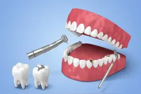 吃东西就塞牙的几种情况，你是哪种？图片