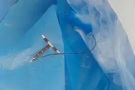 “陪女友去医院，医生从她体内取出来的”女友说是鱼钩？哈哈哈哈～图片