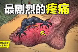 痛风：和生孩子的疼痛机制相同？为什么这是最剧烈的疼痛？图片