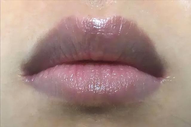女人有没有妇科病，看脸就知道？脸上有几种表现，说明你要当心了