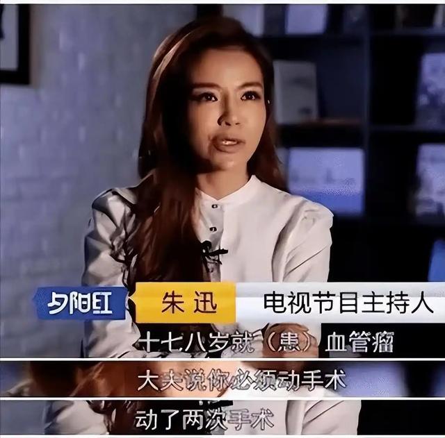 央视主持人朱迅：生命终将结束，为什么不大胆一些