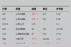 肝损伤严重不严重？一眼就知道图片