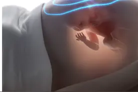 三胎时代，孕妈妈要做好哪些准备？图片