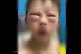 小孩哥一写作业眼睛肿成“鸡蛋”！网友：作业过敏？原因找到了→图片