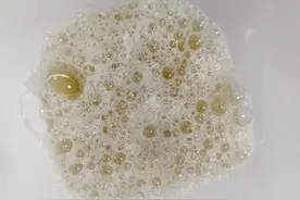 尿尿出现泡沫，是肾不好？医生提醒：或是这3种疾病“通知”图片