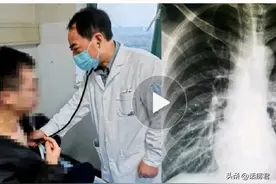 量力而行！男孩跳绳6000下后气胸，医生:瘦人剧烈运动容易气胸！图片