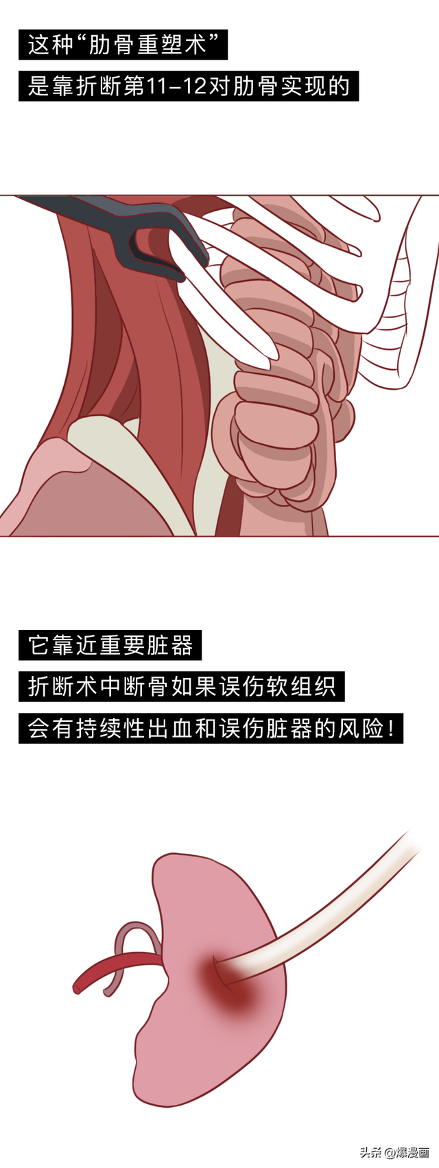 这些女性“刑具”，受到不少女孩追捧！