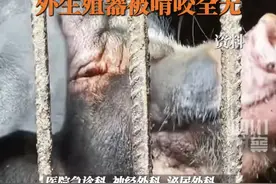 黑龙江66岁大爷遭家猪啃食下半身，外生殖器被啃咬全无图片