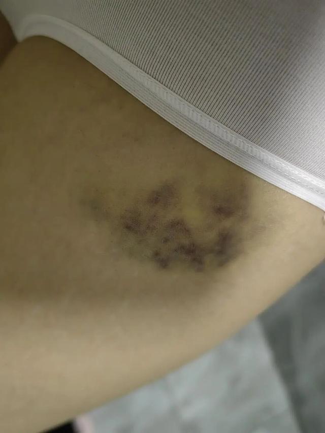 “女护士被男友杀害案”受害人姐姐最新发声：发现多张受害人身体淤青及烫伤自拍照，“父亲一提到我妹就哭”