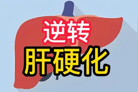 这4个药让肝硬化逆转成为现实，你在吃哪一种？图片