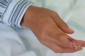 当心“蛇出没”！被毒蛇咬伤怎么办？自救方法请收好→图片