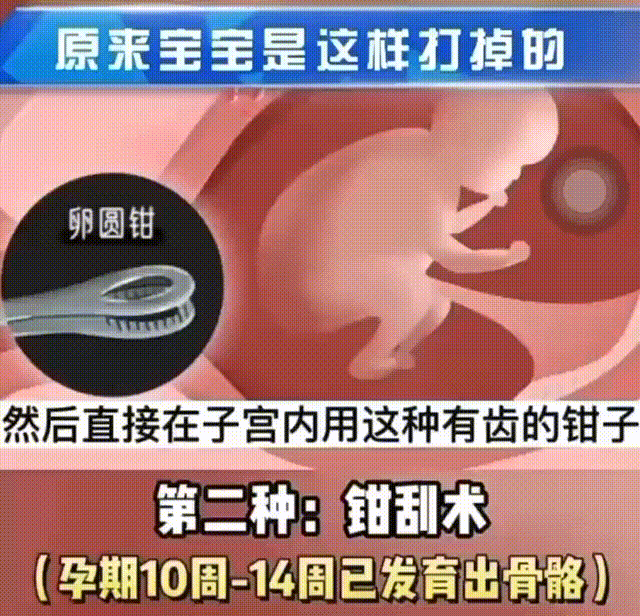 #健康素养提升V计划# 【#人流#只需要几分钟，然后发生了什么？】