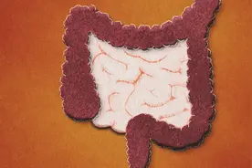 人体内有6公斤的宿便?如何排出“赖着不走”的粪便?医生告诉你图片