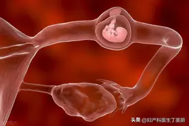 为什么“胎停”越常见？90%的“胎停”，都和这几个原因有关！图片