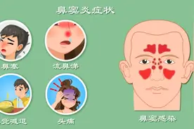 儿童急性鼻窦炎选择头孢克肟还是头孢地尼？为什么？图片