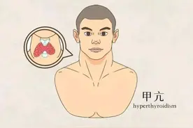 【乐飞说甲状腺】关于碘131治疗甲亢，这些你都知道吗？图片