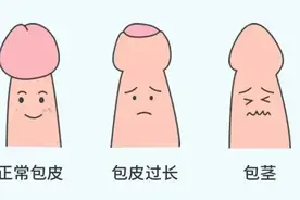 这样做包皮手术，必须给佑佑点个赞！图片