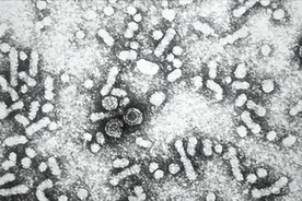 36岁，乙肝小三阳，病毒量37，需要治疗吗？图片