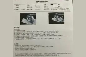 你自己也能看懂产检报告，4大关键检查报告解读，准妈妈必看！图片