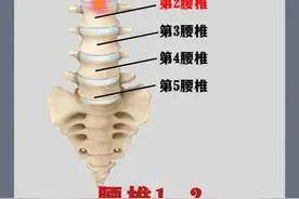 腰突疼痛知多少？从第1到第5腰椎，症状全解析！图片