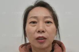 42岁第一次做微创去眼袋，手术40分钟，60天后说出真相图片