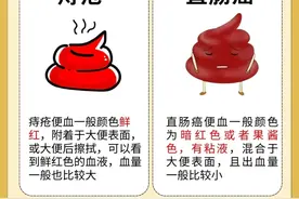 以为是痔疮，结果却是直肠癌？直肠癌与痔疮的区别，你知道吗？图片