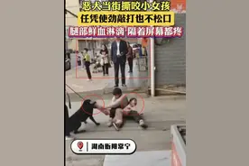 后续来了，恶犬咬伤小女孩，处理结果很意外，狗主人的问题严重了图片