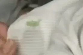 最近广东人的衣服上出现这些绿色小颗粒 千万不能大意要小心谨慎！图片