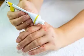 一支红霉素软膏，竟有这么多功效！总结3大作用，快来看！图片